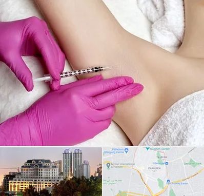 تزریق بوتاکس زیر بغل در فرشته 