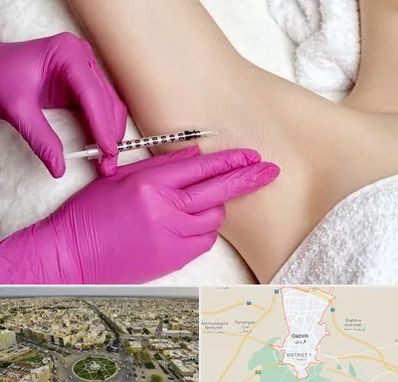 تزریق بوتاکس زیر بغل در قزوین