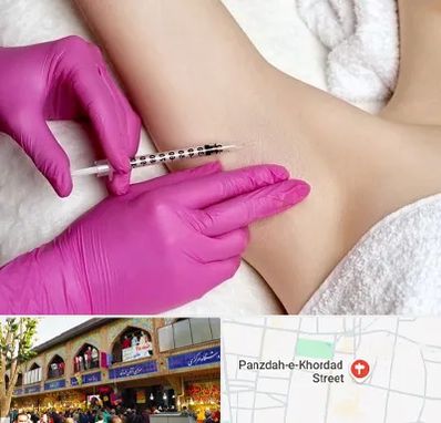 تزریق بوتاکس زیر بغل در 15 خرداد