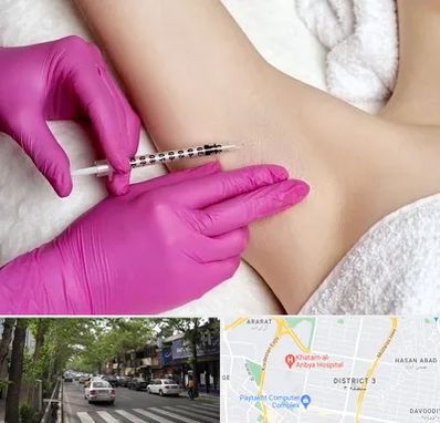 تزریق بوتاکس زیر بغل در ظفر 