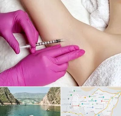 تزریق بوتاکس زیر بغل در ایلام