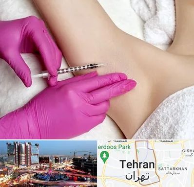 تزریق بوتاکس زیر بغل در صادقیه 