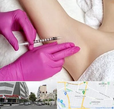 تزریق بوتاکس زیر بغل در بلوار فردوس 
