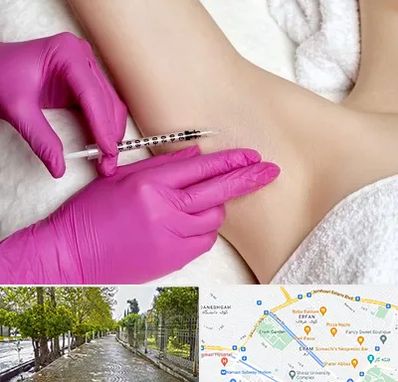 تزریق بوتاکس زیر بغل در خیابان ارم شیراز