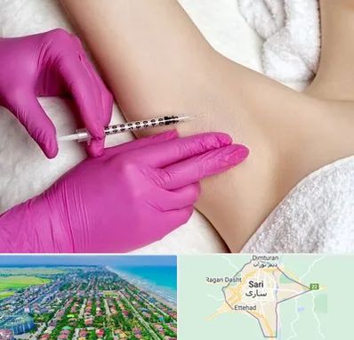 تزریق بوتاکس زیر بغل در ساری