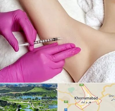 تزریق بوتاکس زیر بغل در خرم آباد