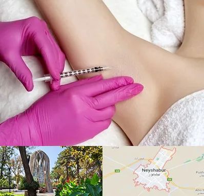 تزریق بوتاکس زیر بغل در نیشابور