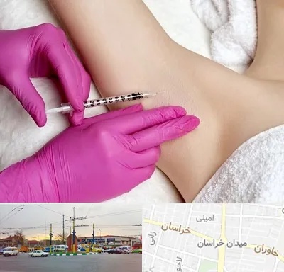تزریق بوتاکس زیر بغل در میدان خراسان