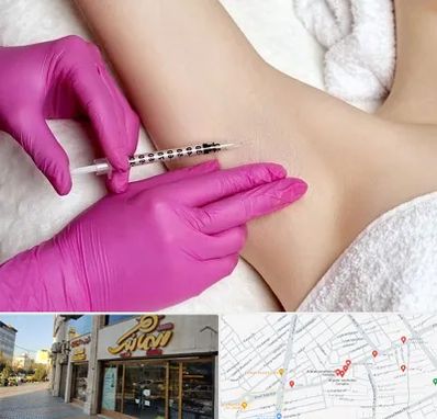 تزریق بوتاکس زیر بغل در عطاران قم