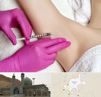 تزریق بوتاکس زیر بغل در شهرضا