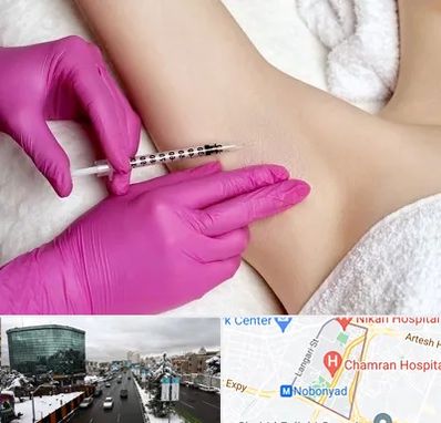 تزریق بوتاکس زیر بغل در اقدسیه 