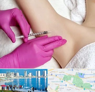 تزریق بوتاکس زیر بغل در چیتگر 