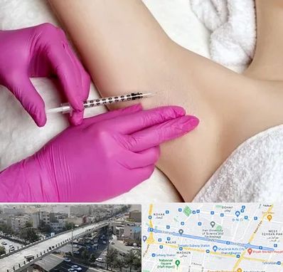 تزریق بوتاکس زیر بغل در فرجام