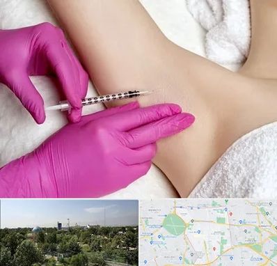 تزریق بوتاکس زیر بغل در منطقه 16 تهران 