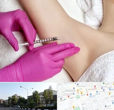 تزریق بوتاکس زیر بغل در میدان کاج 