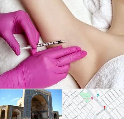 تزریق بوتاکس زیر بغل در مصلی مشهد
