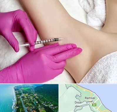 تزریق بوتاکس زیر بغل در رامسر