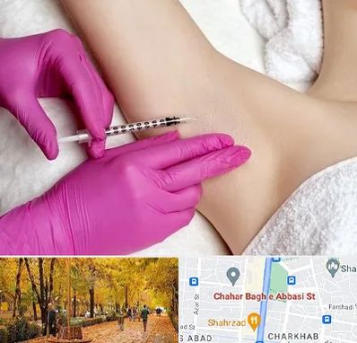 تزریق بوتاکس زیر بغل در چهارباغ اصفهان