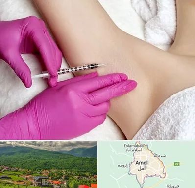 تزریق بوتاکس زیر بغل در آمل