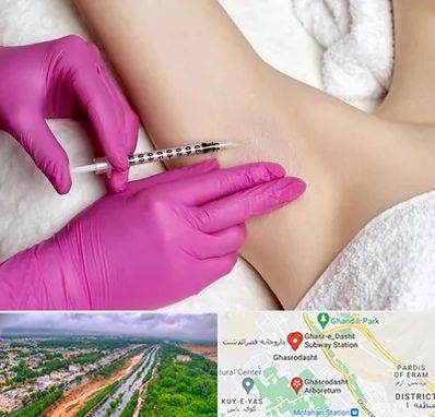 تزریق بوتاکس زیر بغل در قصرالدشت شیراز