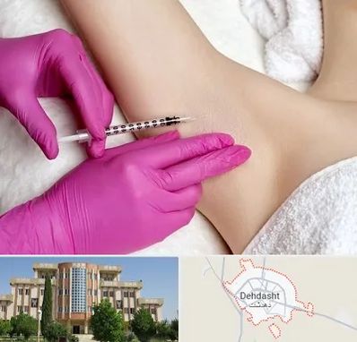 تزریق بوتاکس زیر بغل در دهدشت