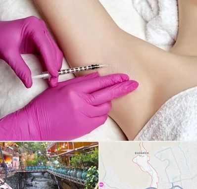 تزریق بوتاکس زیر بغل در درکه