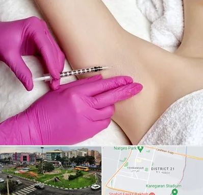 تزریق بوتاکس زیر بغل در تهرانسر 