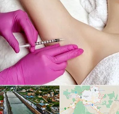 تزریق بوتاکس زیر بغل در مراغه