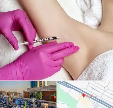 تزریق بوتاکس زیر بغل در لاله پارک تبریز