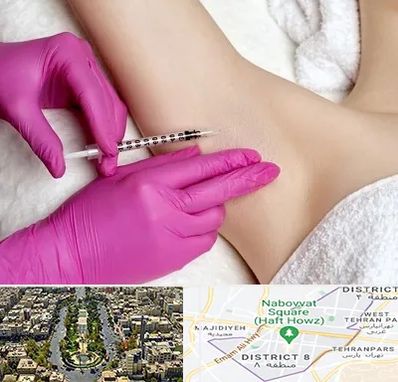 تزریق بوتاکس زیر بغل در نارمک 