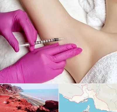 تزریق بوتاکس زیر بغل در هرمزگان
