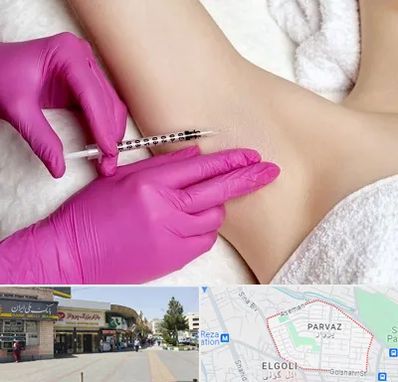 تزریق بوتاکس زیر بغل در پرواز تبریز