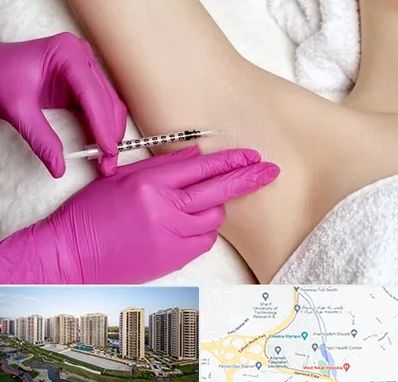 تزریق بوتاکس زیر بغل در المپیک 