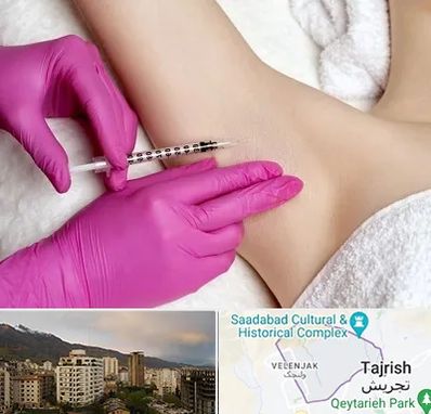 تزریق بوتاکس زیر بغل در زعفرانیه 