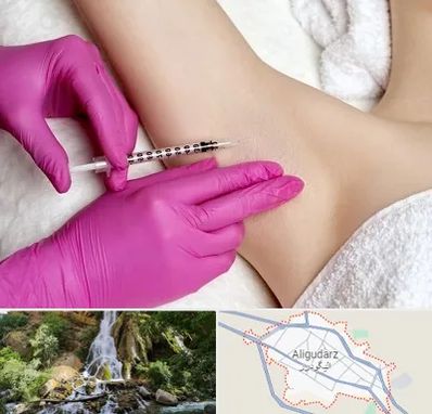 تزریق بوتاکس زیر بغل در الیگودرز