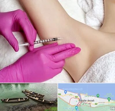 تزریق بوتاکس زیر بغل در بندر انزلی