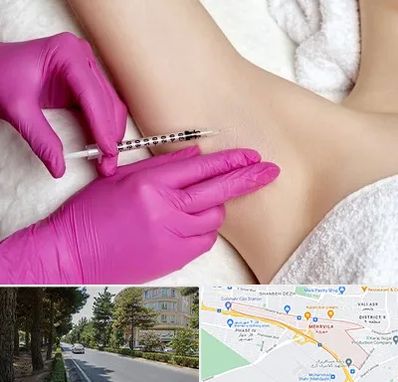 تزریق بوتاکس زیر بغل در مهرویلا کرج