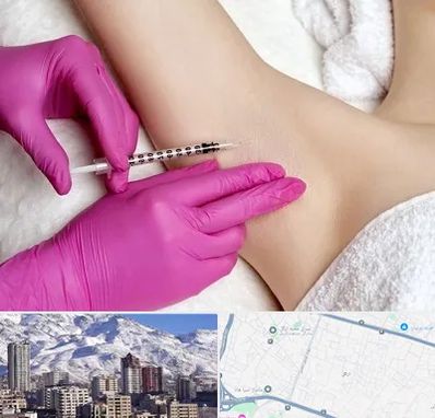 تزریق بوتاکس زیر بغل در ازگل