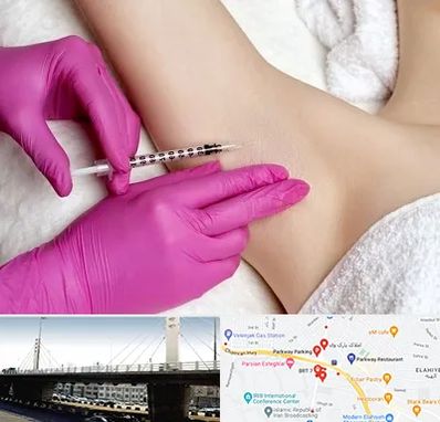 تزریق بوتاکس زیر بغل در پارک وی 