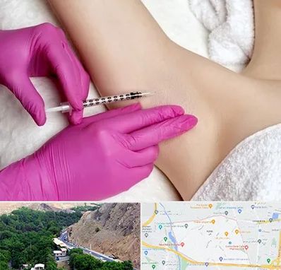 تزریق بوتاکس زیر بغل در کن 