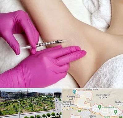 تزریق بوتاکس زیر بغل در پردیس