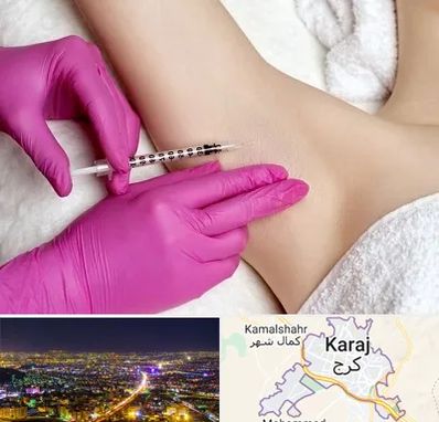 تزریق بوتاکس زیر بغل در کرج