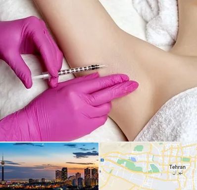 تزریق بوتاکس زیر بغل در غرب تهران 
