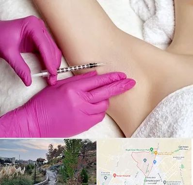 تزریق بوتاکس زیر بغل در باغستان کرج