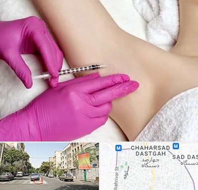 تزریق بوتاکس زیر بغل در چهارصد دستگاه 