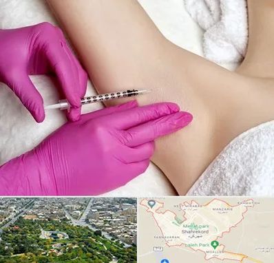 تزریق بوتاکس زیر بغل در شهرکرد