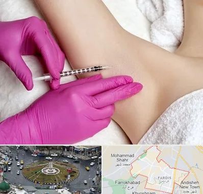 تزریق بوتاکس زیر بغل در فردیس کرج 