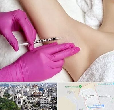 تزریق بوتاکس زیر بغل در ولنجک 