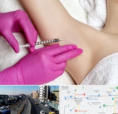 تزریق بوتاکس زیر بغل در پیروزی 