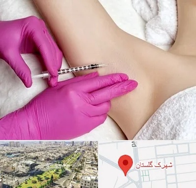 تزریق بوتاکس زیر بغل در شهرک گلستان